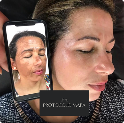 Cópia de passe para o lado e v eja a transformação! (Post para Instagram (45)) (10)