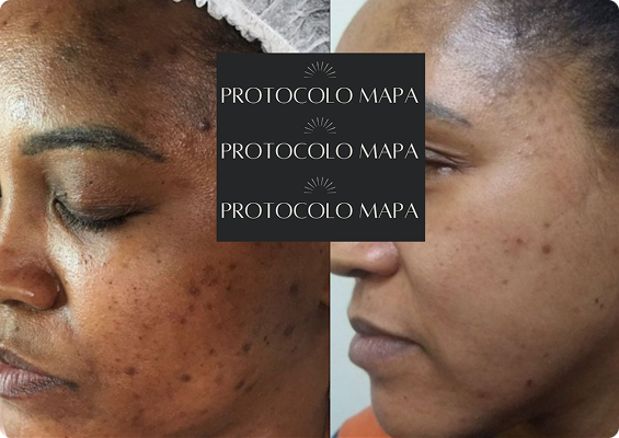 Cópia de passe para o lado e v eja a transformação! (Post para Instagram (45)) (12)