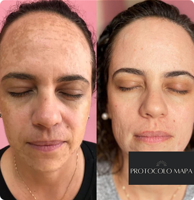 Cópia de passe para o lado e v eja a transformação! (Post para Instagram (45)) (13)