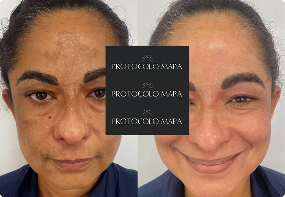 Cópia de passe para o lado e v eja a transformação! (Post para Instagram (45)) (14)