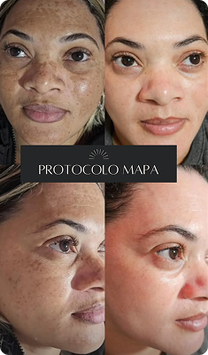 Cópia de passe para o lado e v eja a transformação! (Post para Instagram (45)) (15)