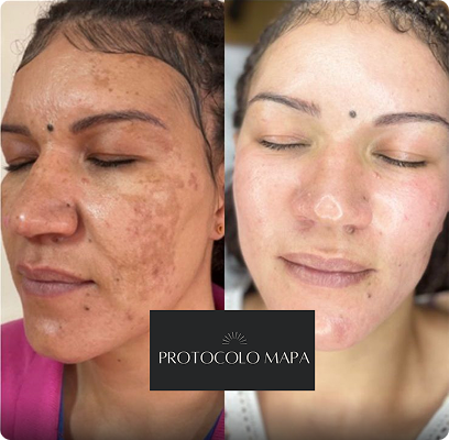 Cópia de passe para o lado e v eja a transformação! (Post para Instagram (45)) (9)